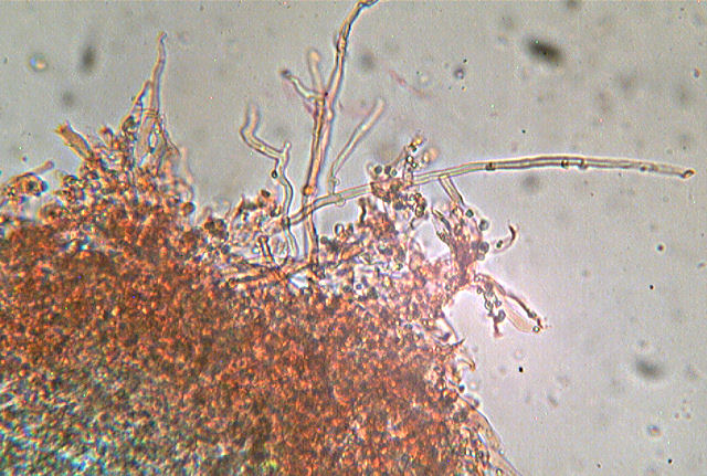 Hyphoderma sambuci